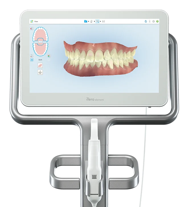 Scanner intraoral iTero Element 2 — captura digital 3D dos dentes